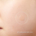 Acne pimple canteiro absorvendo hidrocolóide invisível patch
